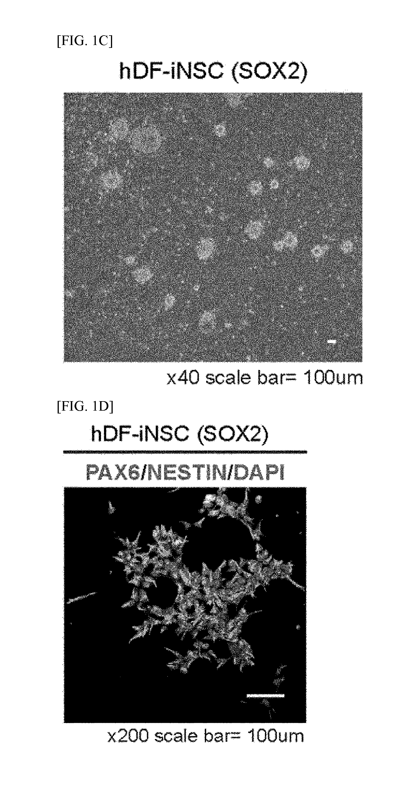 Method of Preparing Induced Neural Stem Cells Reprogrammed from Non-Neuronal Cells Using HMGA2