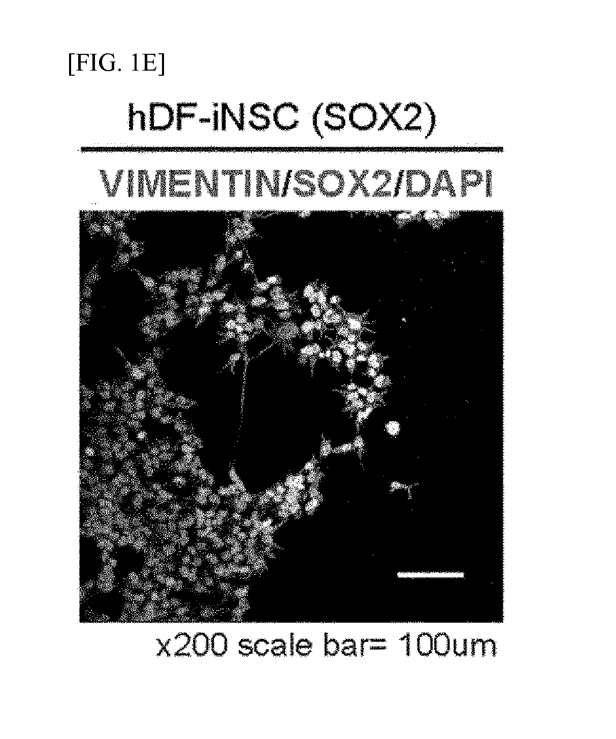 Method of Preparing Induced Neural Stem Cells Reprogrammed from Non-Neuronal Cells Using HMGA2