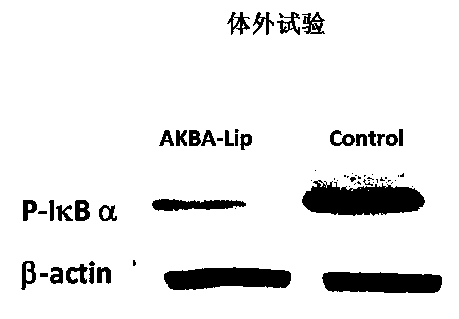 Composition for treating psoriasis and preparation method thereof