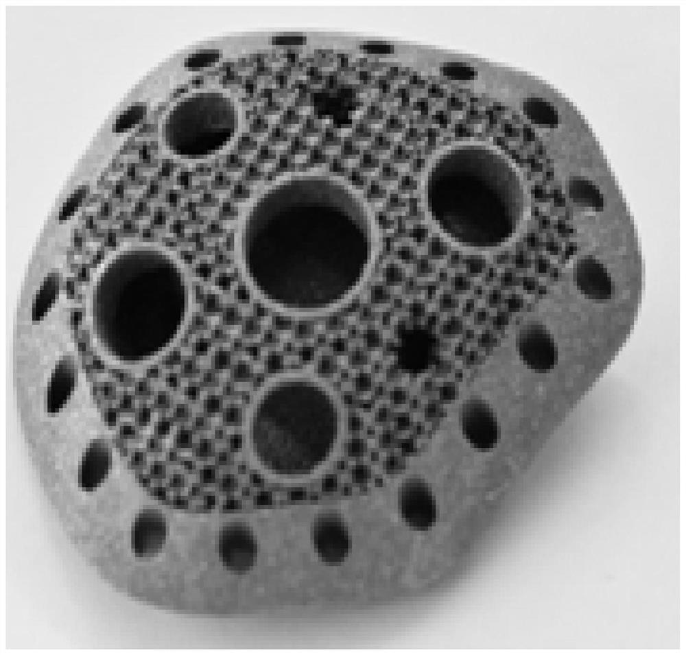 A manufacturing method of laser additive manufacturing-high temperature vacuum sintering porous tantalum bone implant prosthesis with bone-imitation trabecular structure