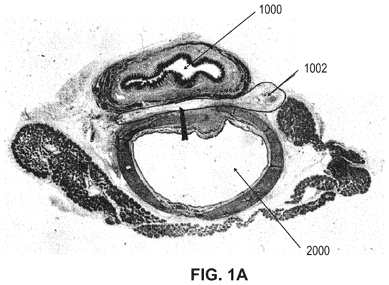 Systems and methods for visceral neuromodulation