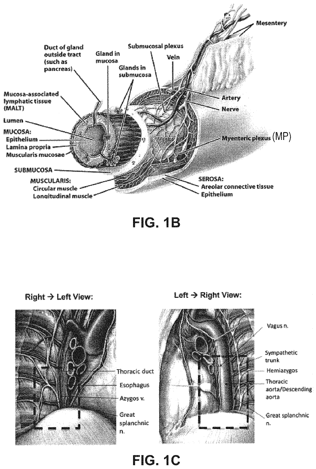 Systems and methods for visceral neuromodulation