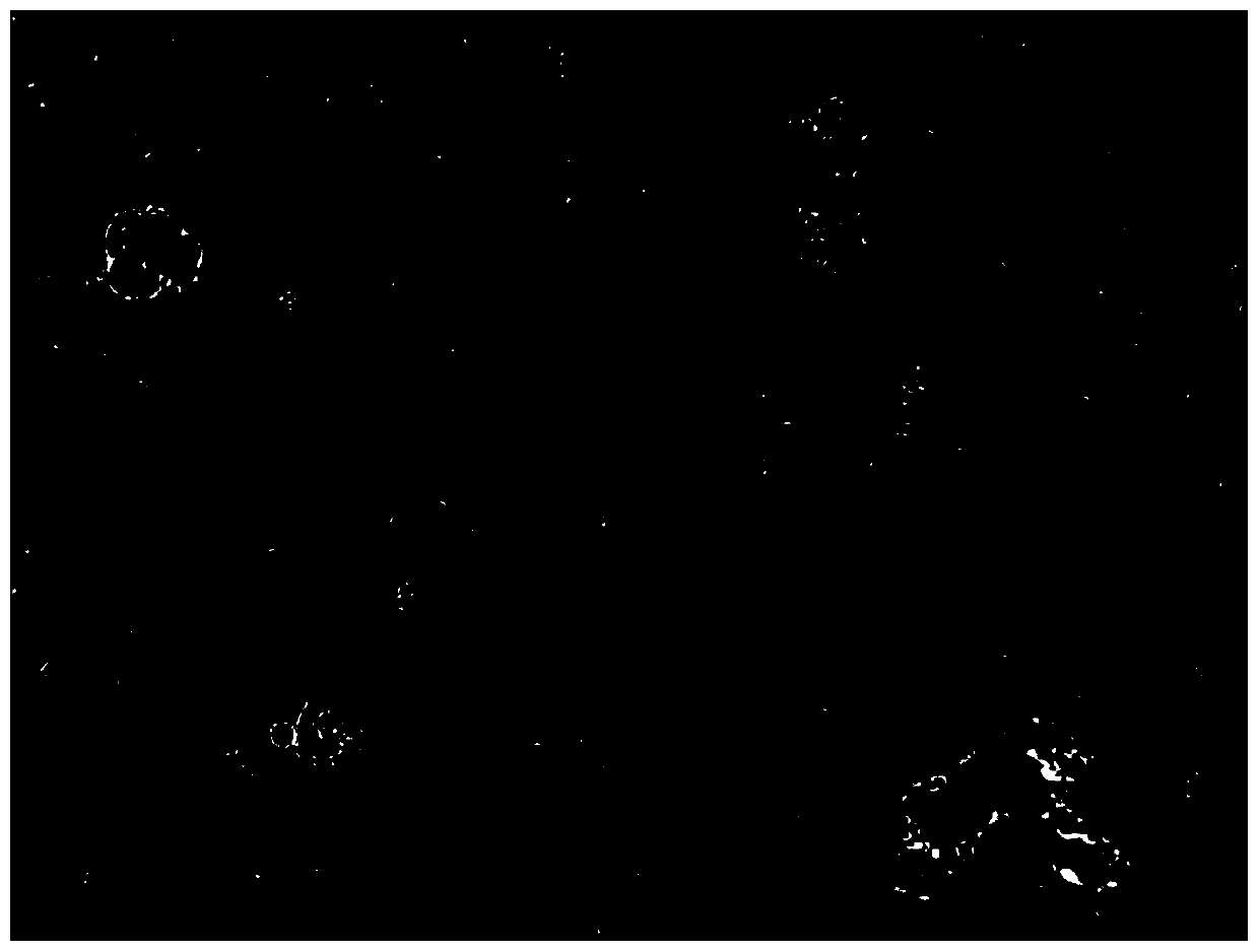 Classification and recognition method of formed components in stool microscopy images based on machine vision