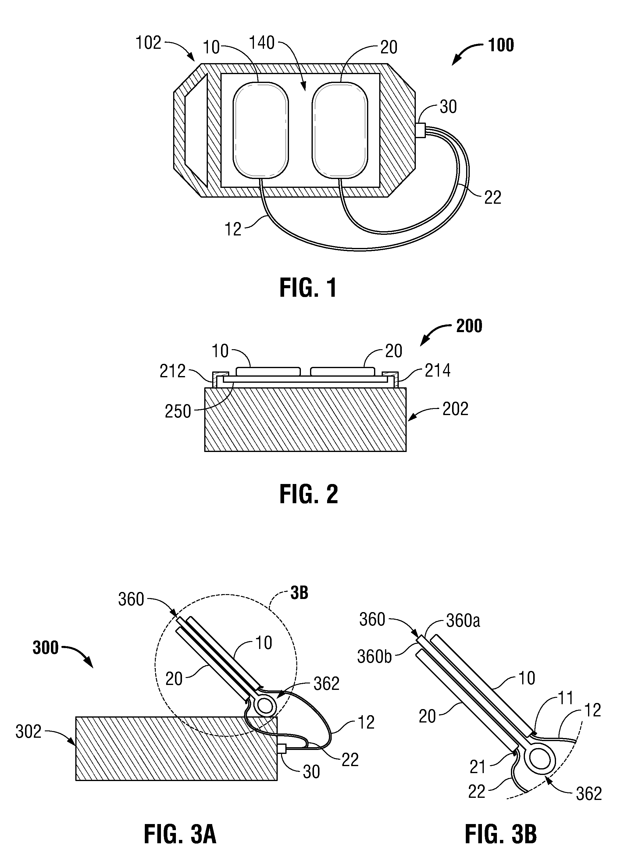 Electrode Delivery System