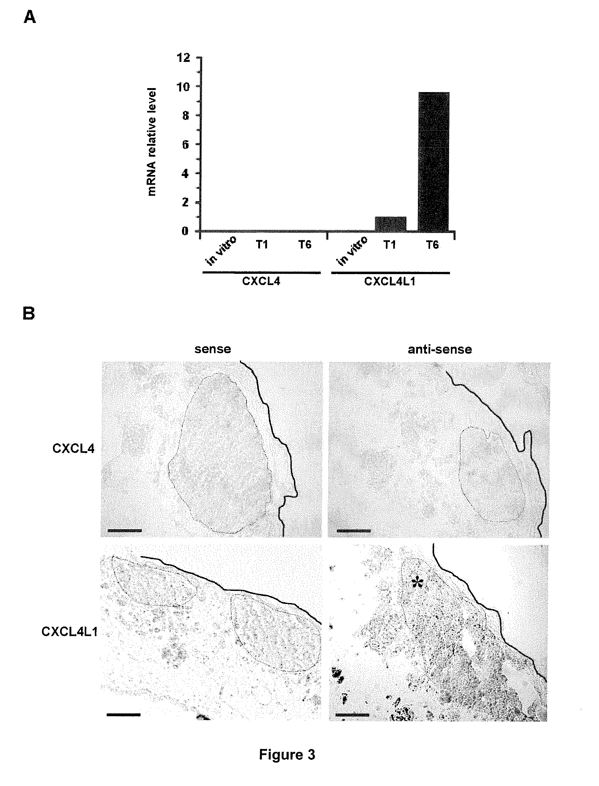 Cxcl4l1 as a biomarker of pancreatic cancer