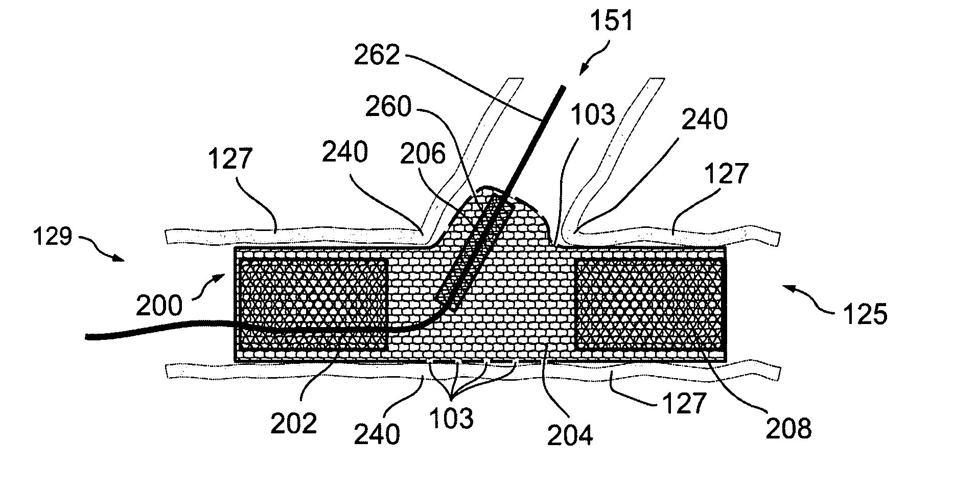 Bifurcated stent assemblies