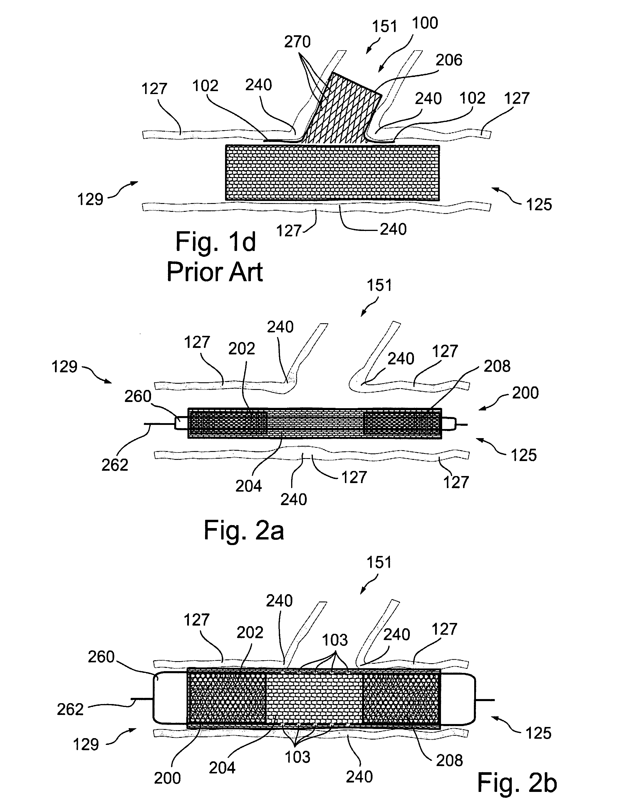 Bifurcated stent assemblies