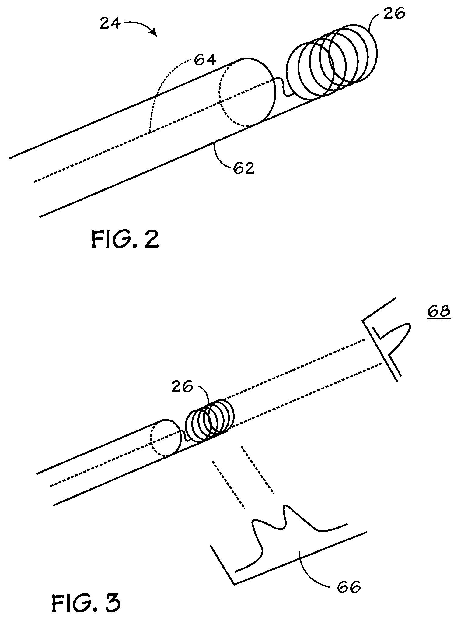 Method for multiplexed MR tracking