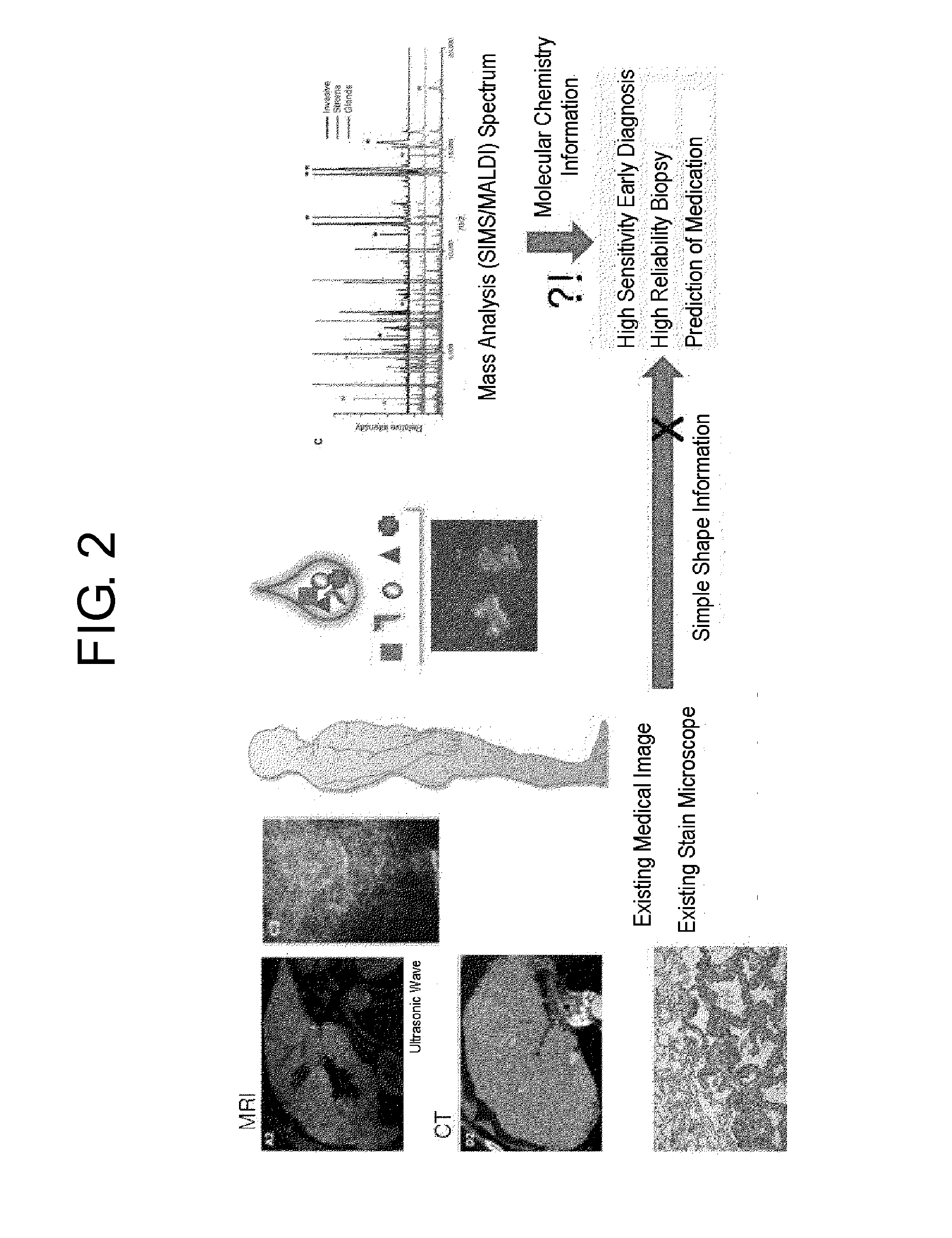 Flight time based mass microscope system for ultra high-speed multi mode mass analysis