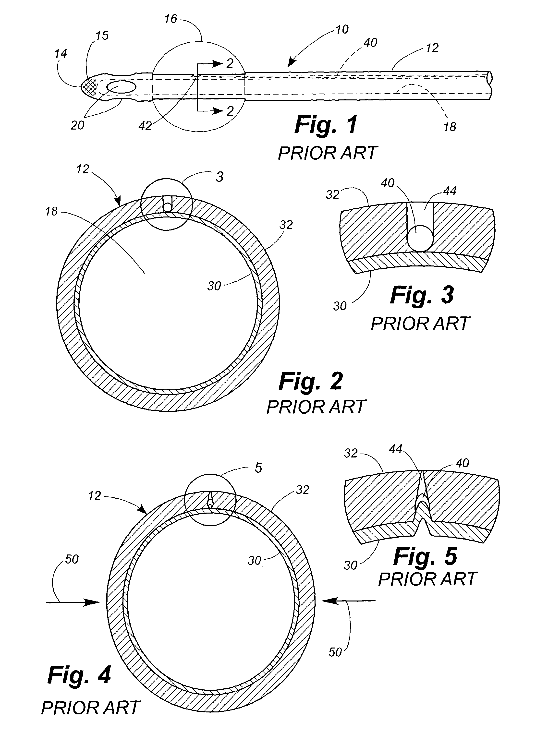 Balloon catheter with improved resistance to non-deflation