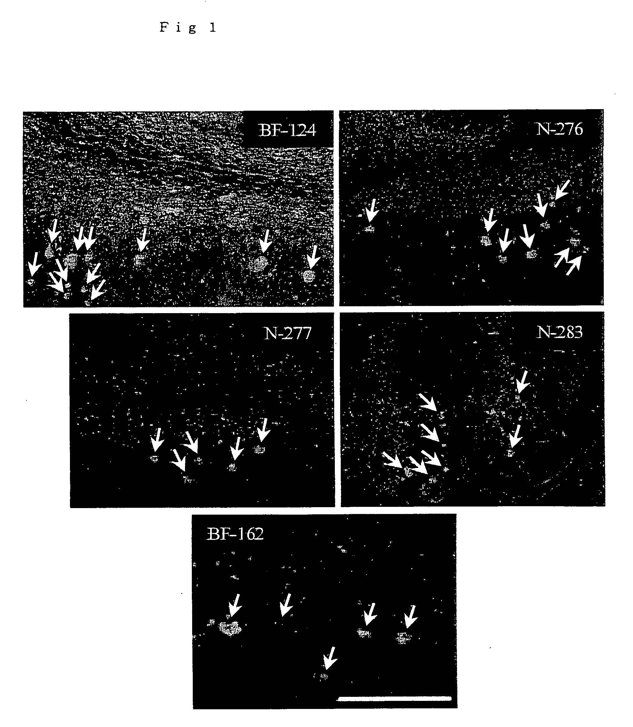 Diagnostic probes and remedies for diseases with accumulation of prion protein, and stains for prion protein