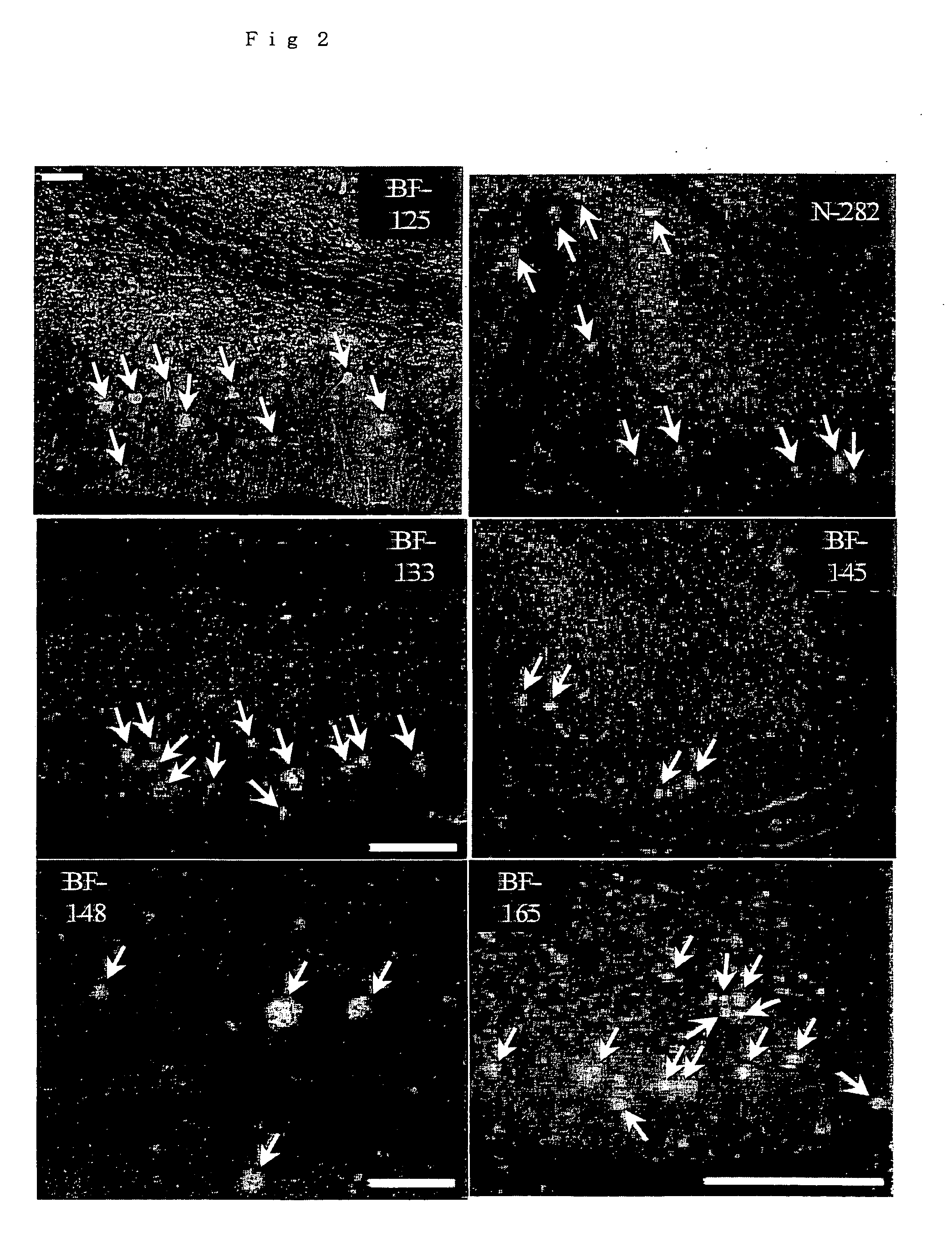 Diagnostic probes and remedies for diseases with accumulation of prion protein, and stains for prion protein