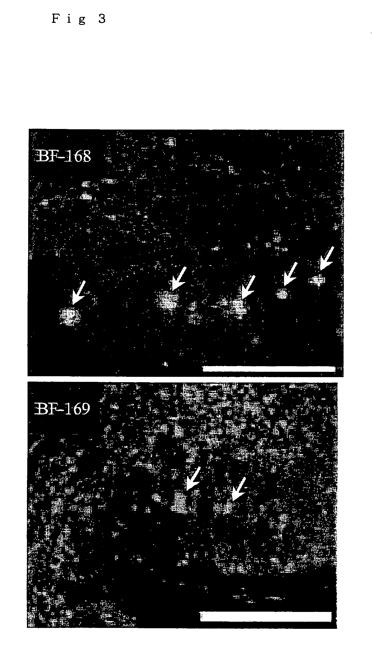 Diagnostic probes and remedies for diseases with accumulation of prion protein, and stains for prion protein