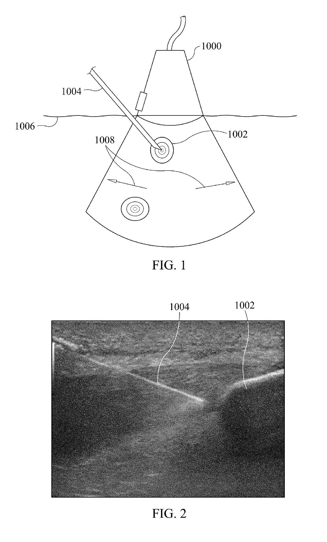 Laser assisted ultrasound guidance