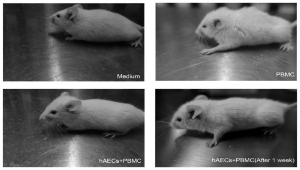 Use of human amniotic epithelial cells in the treatment of graft-versus-host disease