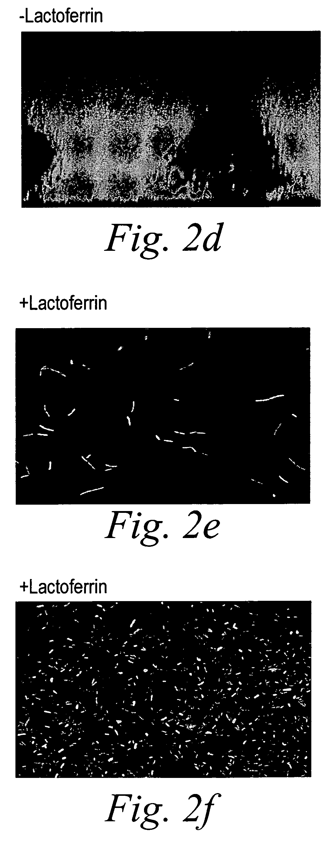 Methods of inhibiting and treating bacterial biofilms by metal chelators