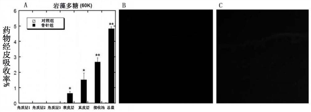 A kind of transdermal absorption composition and its application in the preparation of transdermal absorption preparation