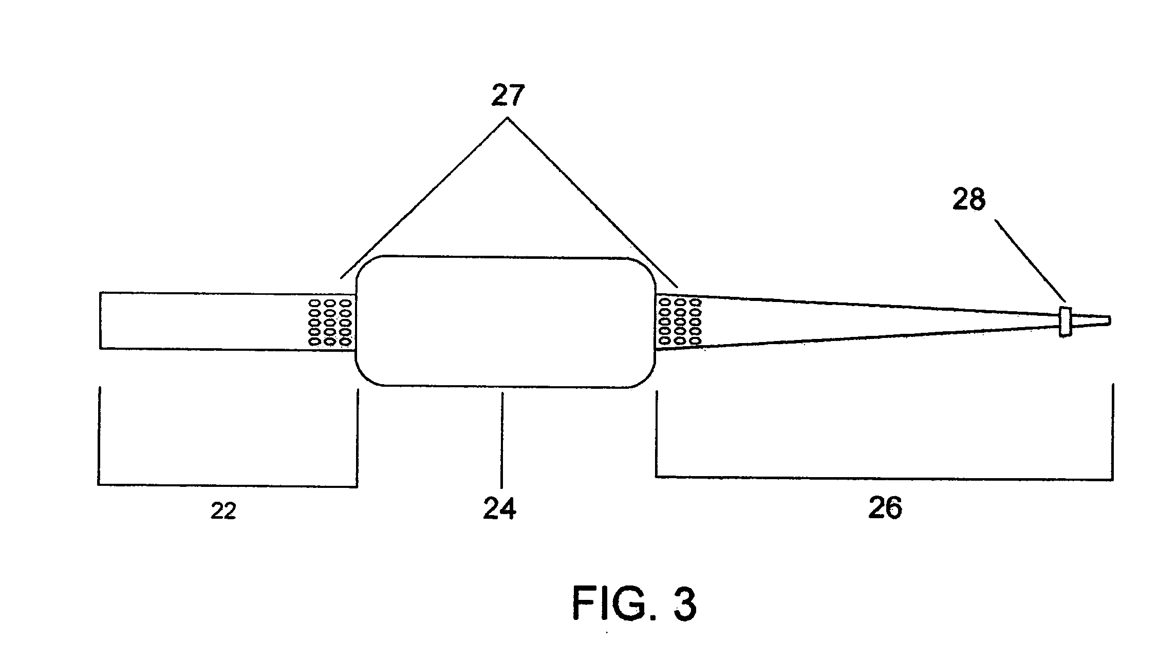 Angioplasty device