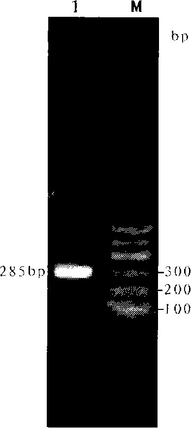 Yeast engineering bacterium for expression recombination of rainbow trout antimicrobial peptide Oncorhyncin II and preparation method thereof