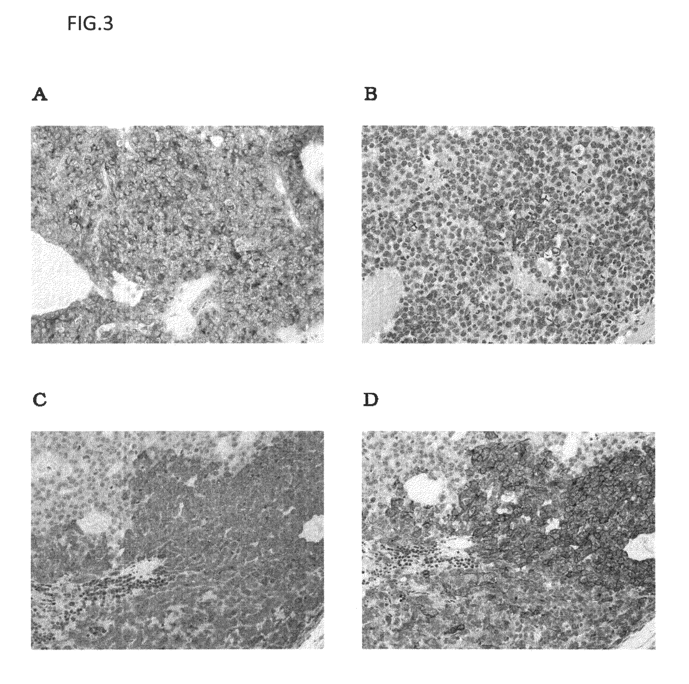 Method for detection of liver cancer cell using anti-glypican-3 antibody