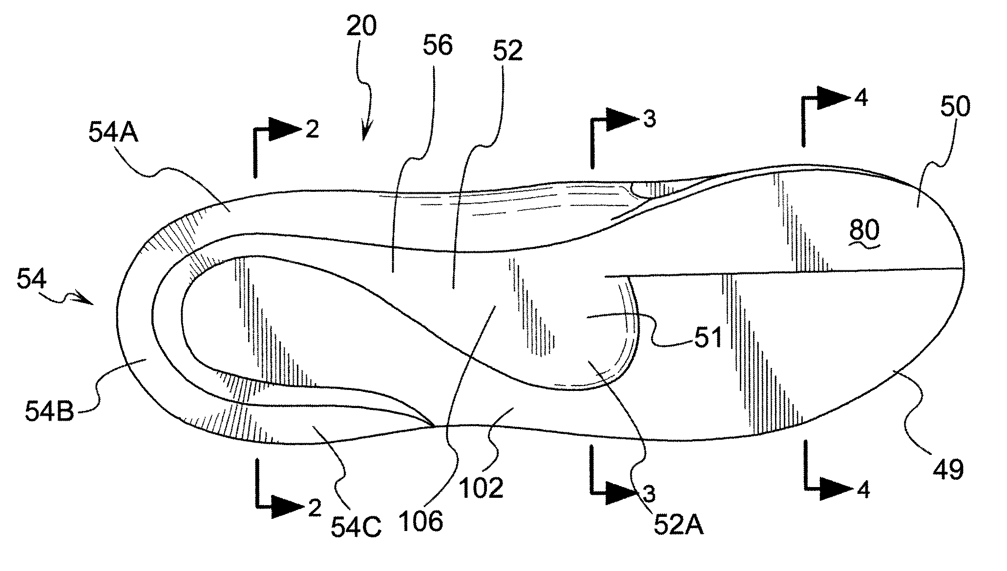 First metatarsal head lift orthotic