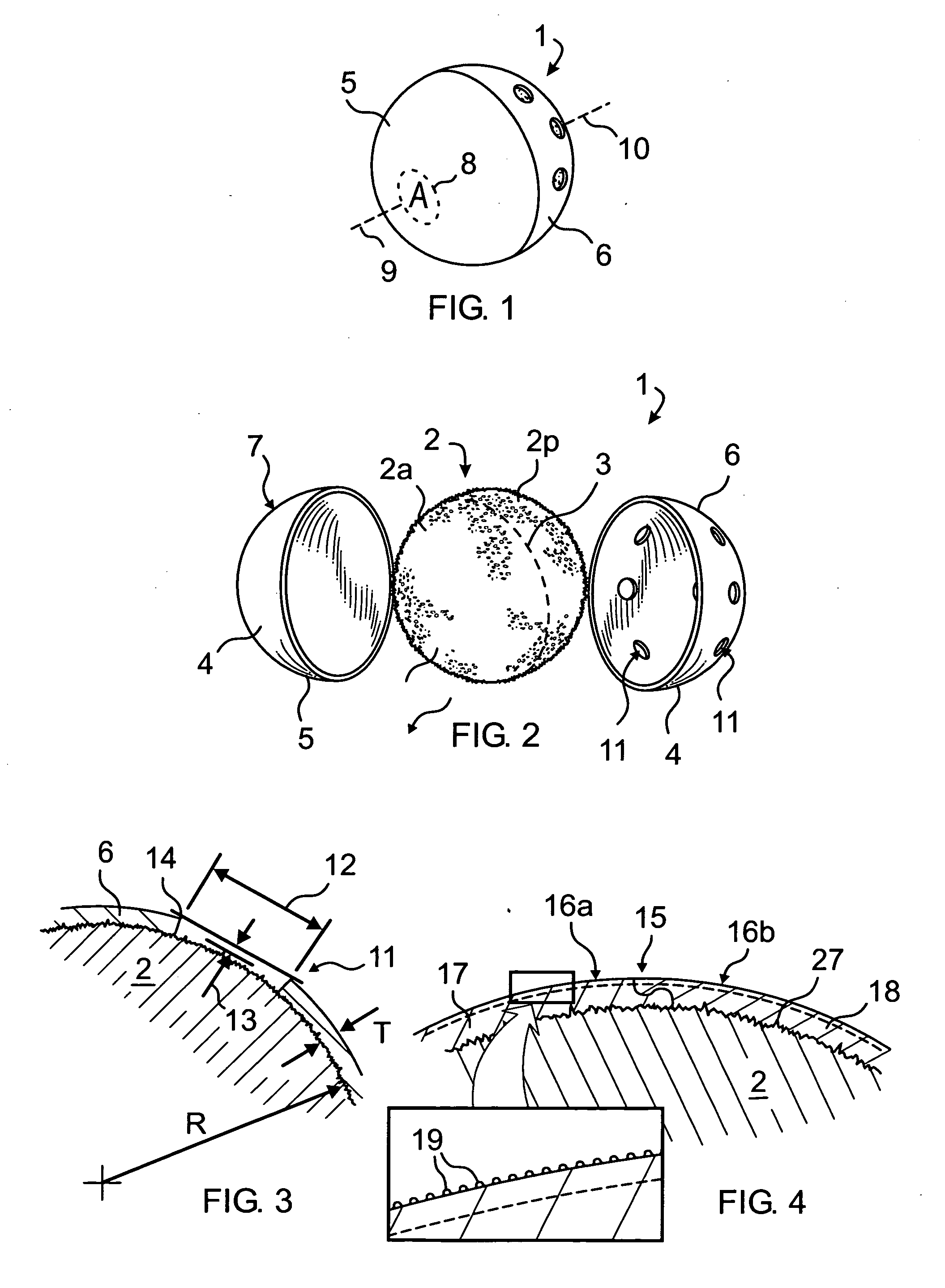 Vaulted perforated coating for orbital implants