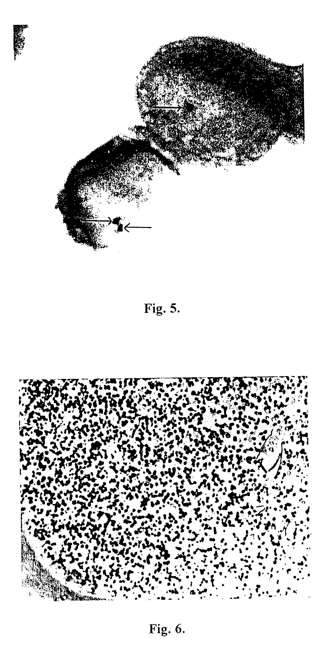 Kit for detecting Her-2/neu gene by site-specific metal deposition