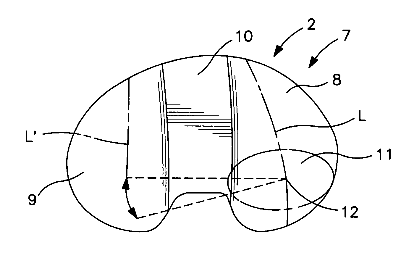 Artificial knee joint