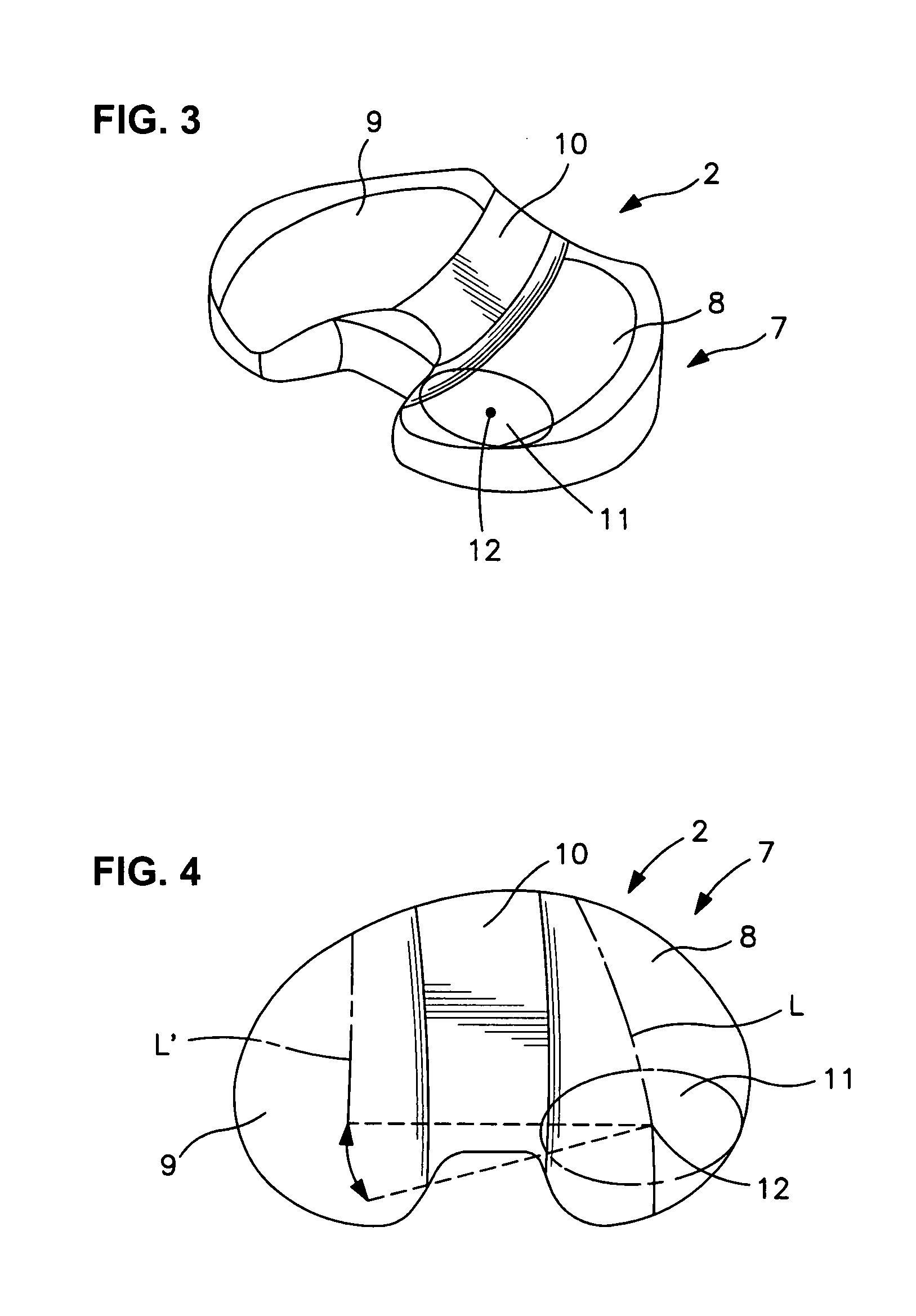 Artificial knee joint