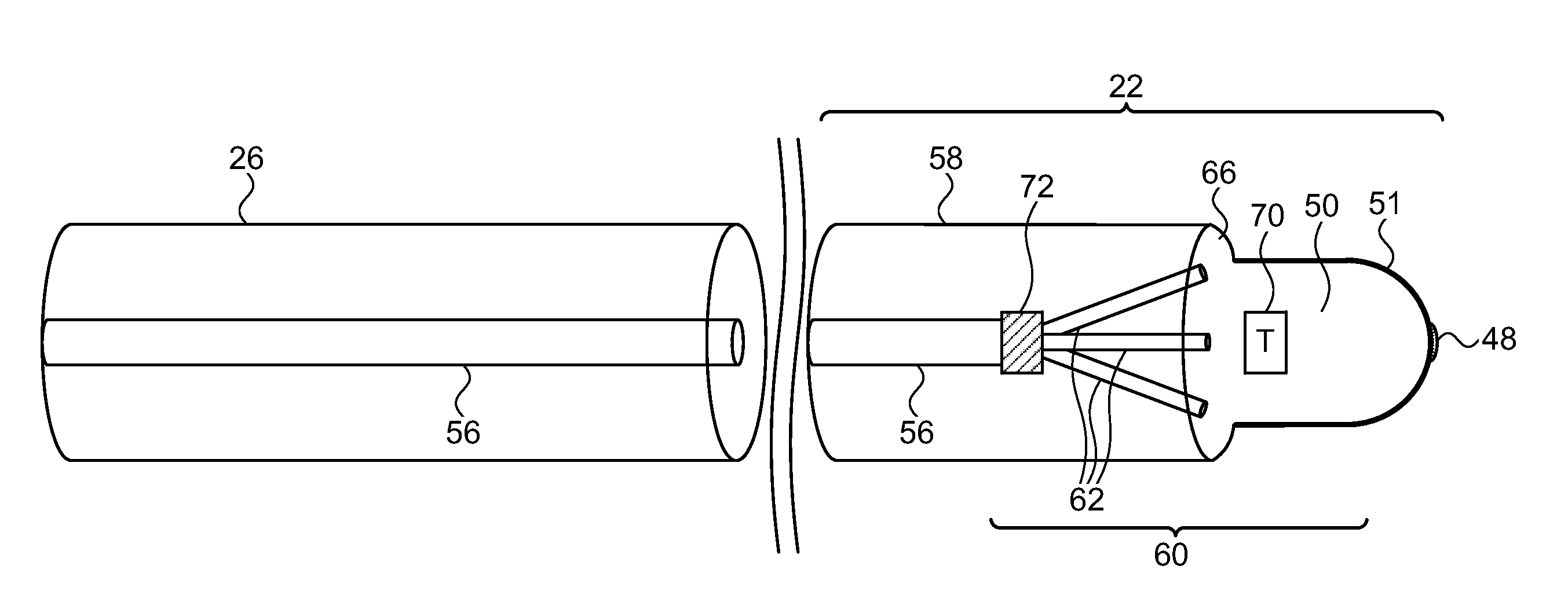 Catheter with spray irrigation