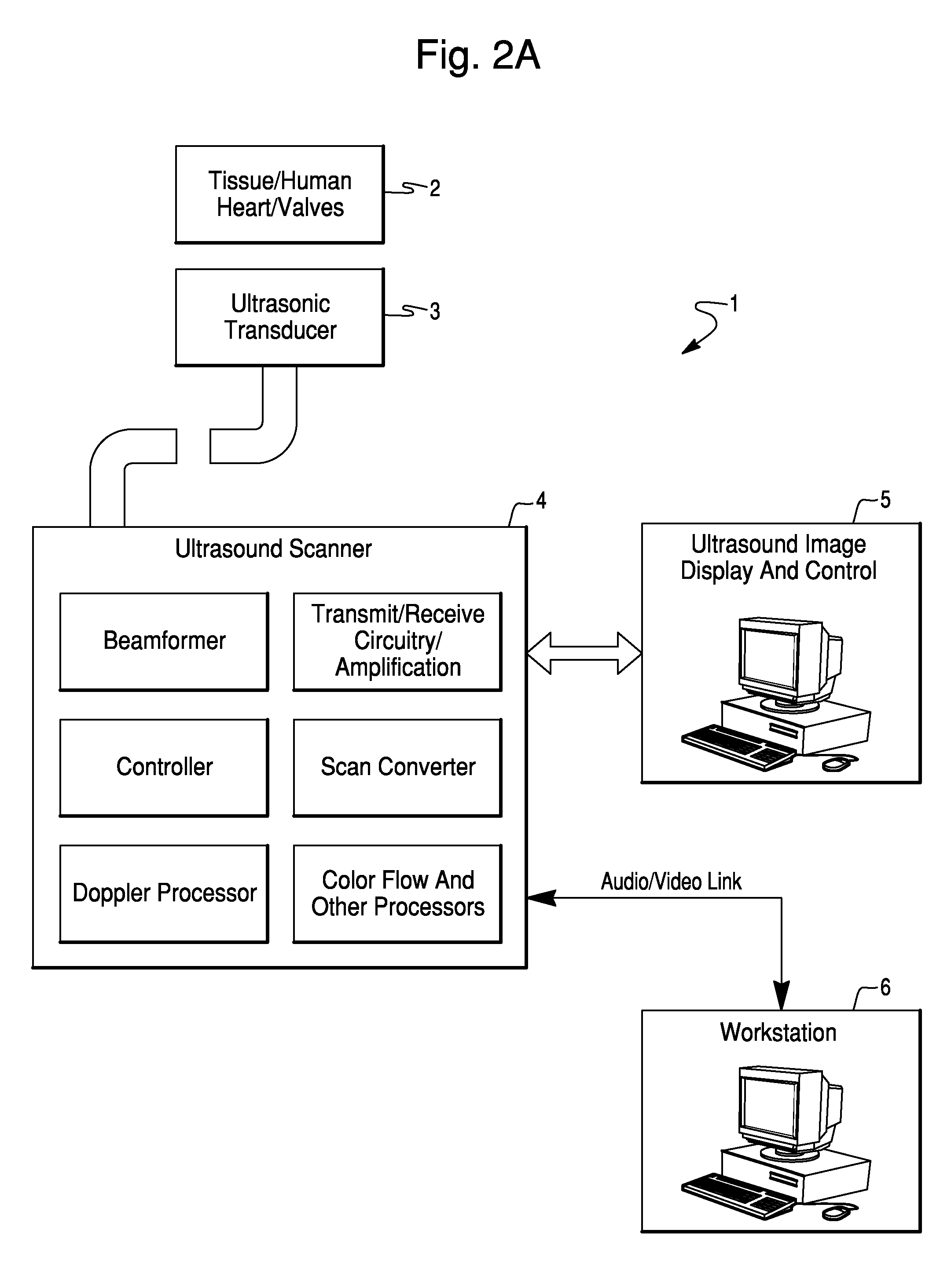 Method and System For Estimating Cardiac Ejection Volume And Placing Pacemaker Electrodes Using Speckle Tracking