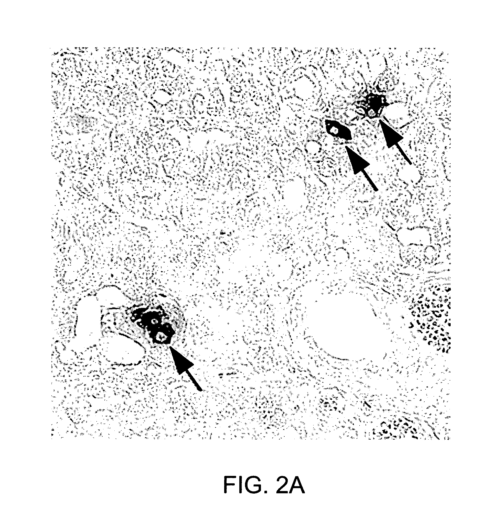 Neurogenin 3 promoter