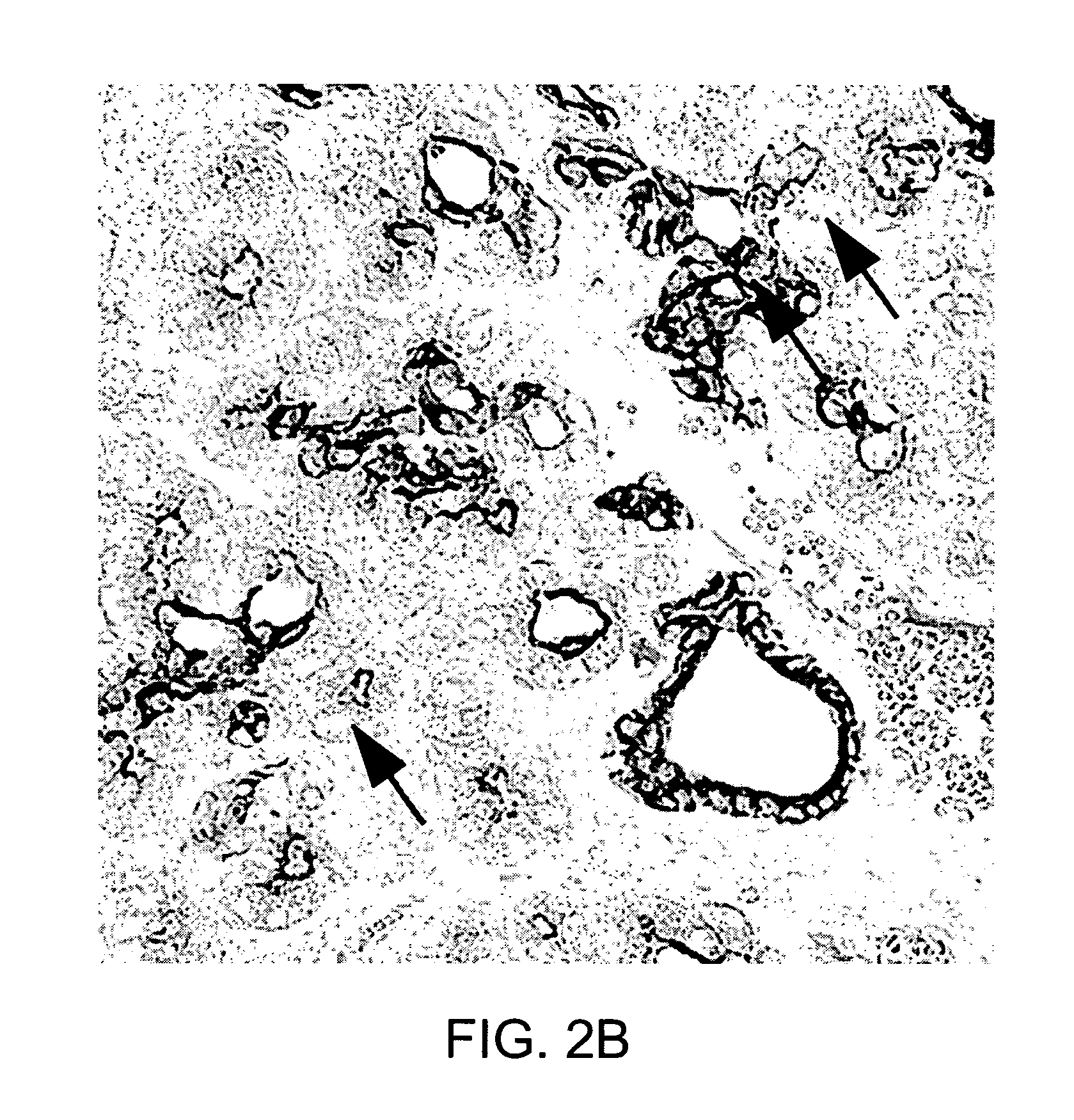 Neurogenin 3 promoter