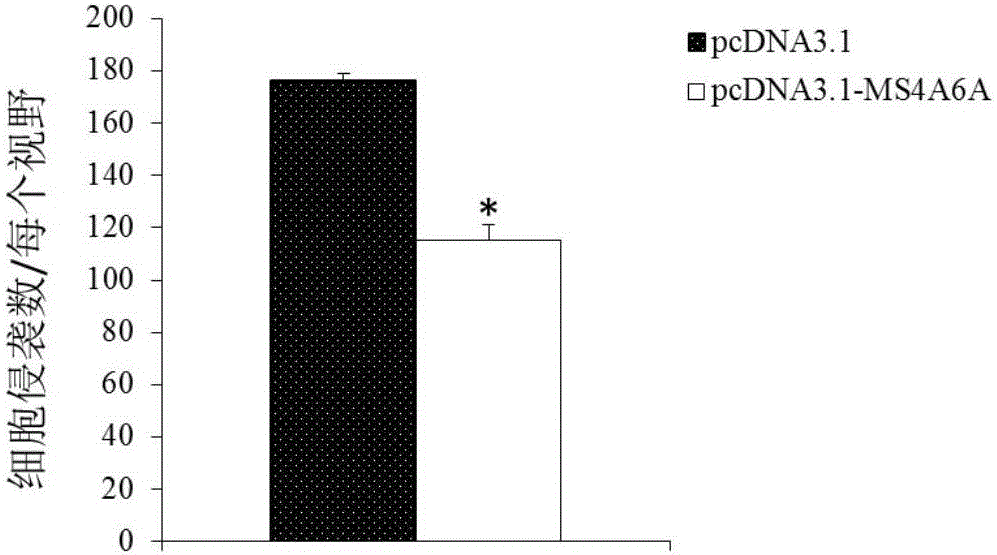 Application of MS4A6A serving as multiple myeloma diagnosis and treatment marker