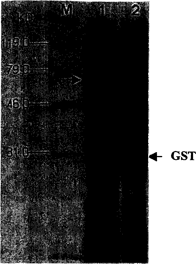 Non-structural protein gene 3ABC of foot-and-mouth disease virus and its preparation and use