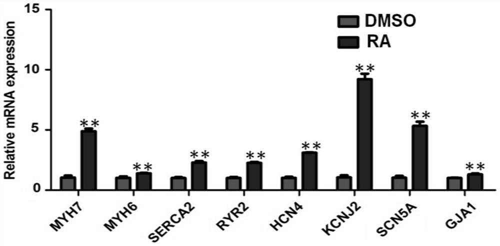 Method for promoting the differentiation of pluripotent stem cells into cardiomyocytes