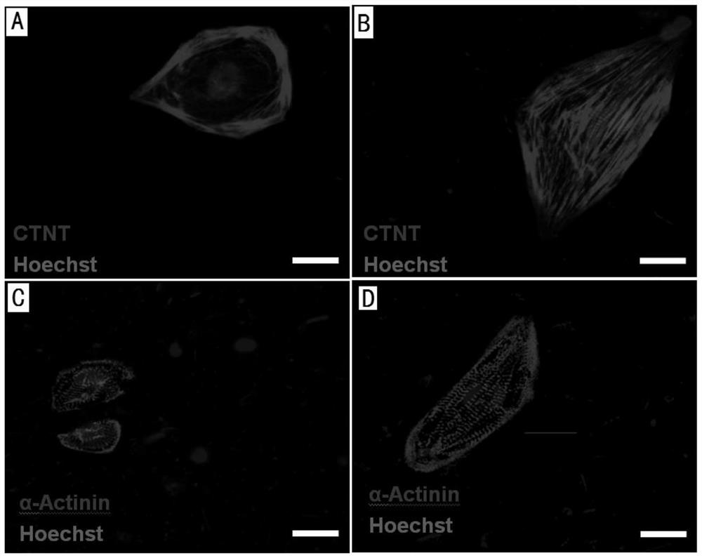 Method for promoting the differentiation of pluripotent stem cells into cardiomyocytes