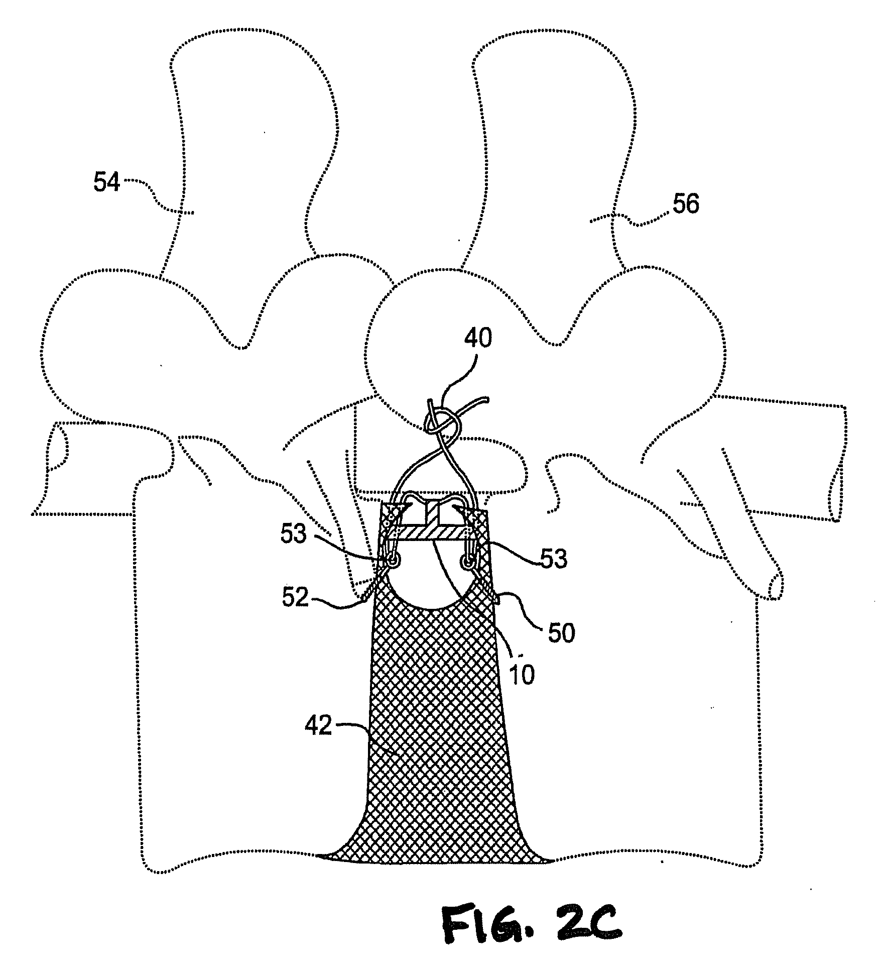 Method and apparatus for the treatment of the intervertebral disc annulus