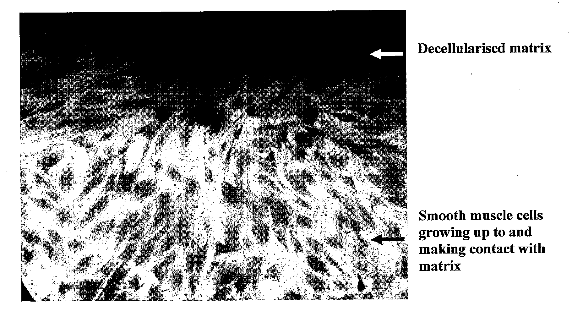 Decellularisation of tissue matrices for bladder implantation