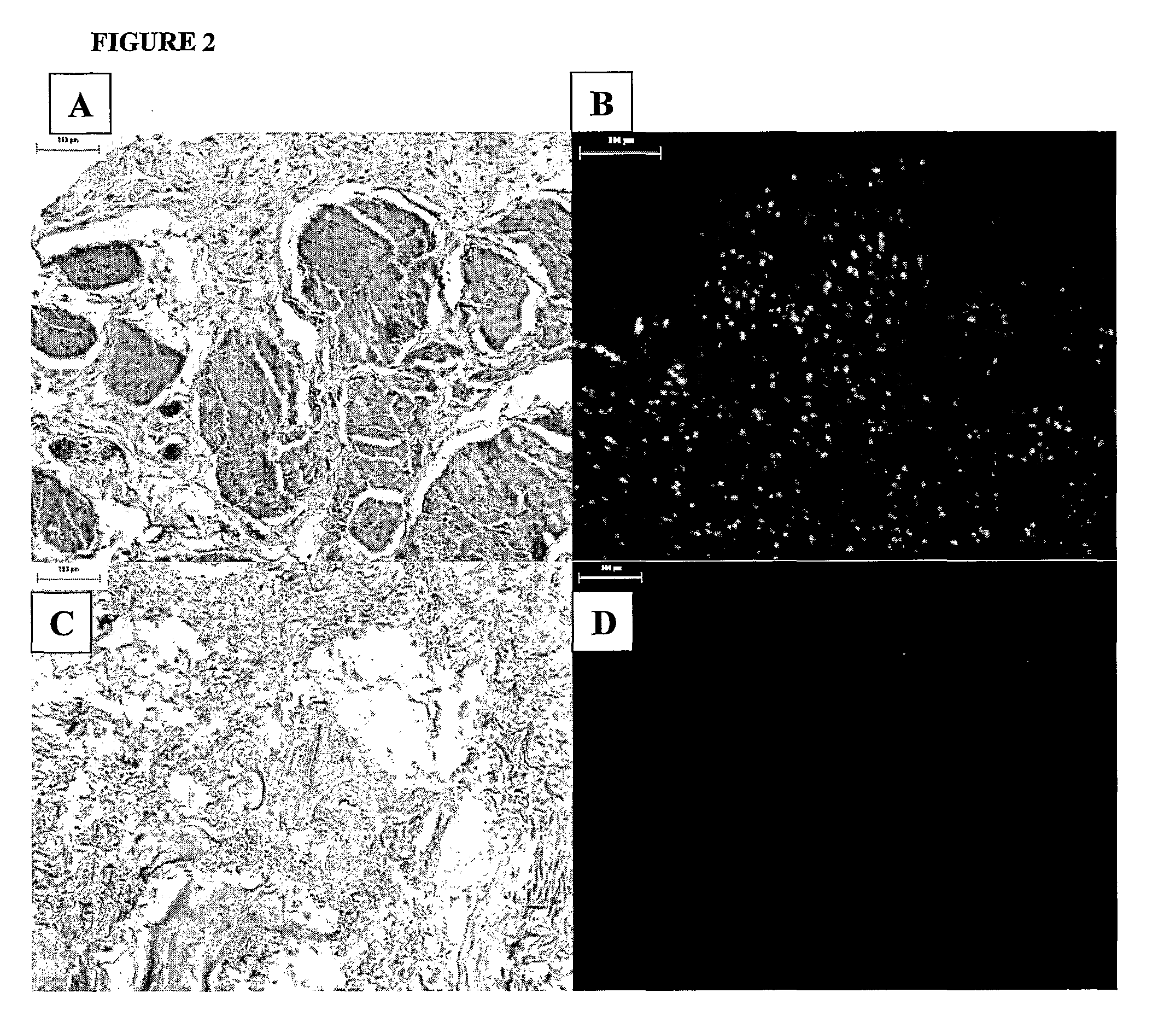 Decellularisation of tissue matrices for bladder implantation