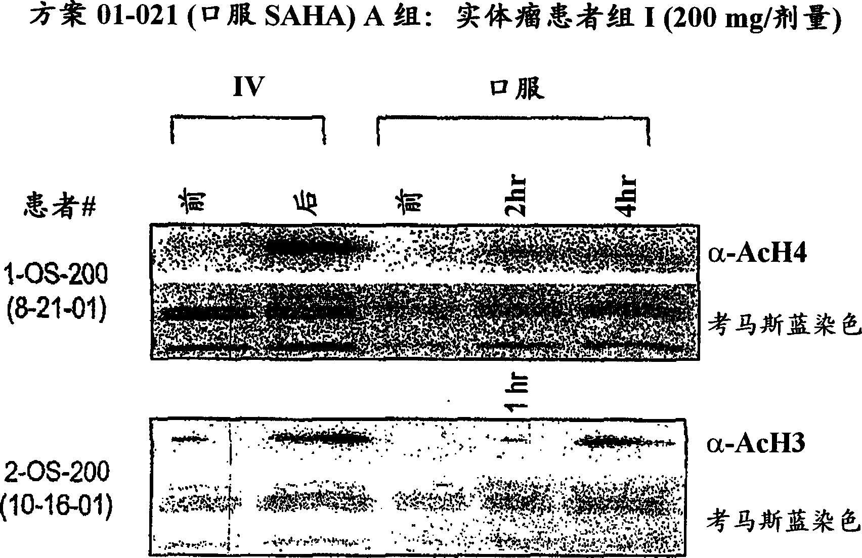 Methods of treating cancer with HDAC inhibitors