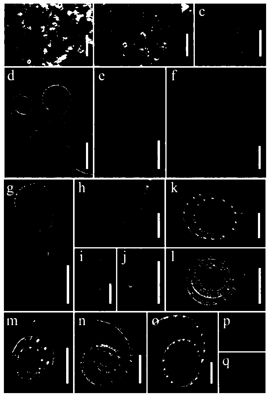 Application of tubeufia rubra in preparation of drugs for reversing tumor multidrug resistance to sensitivity