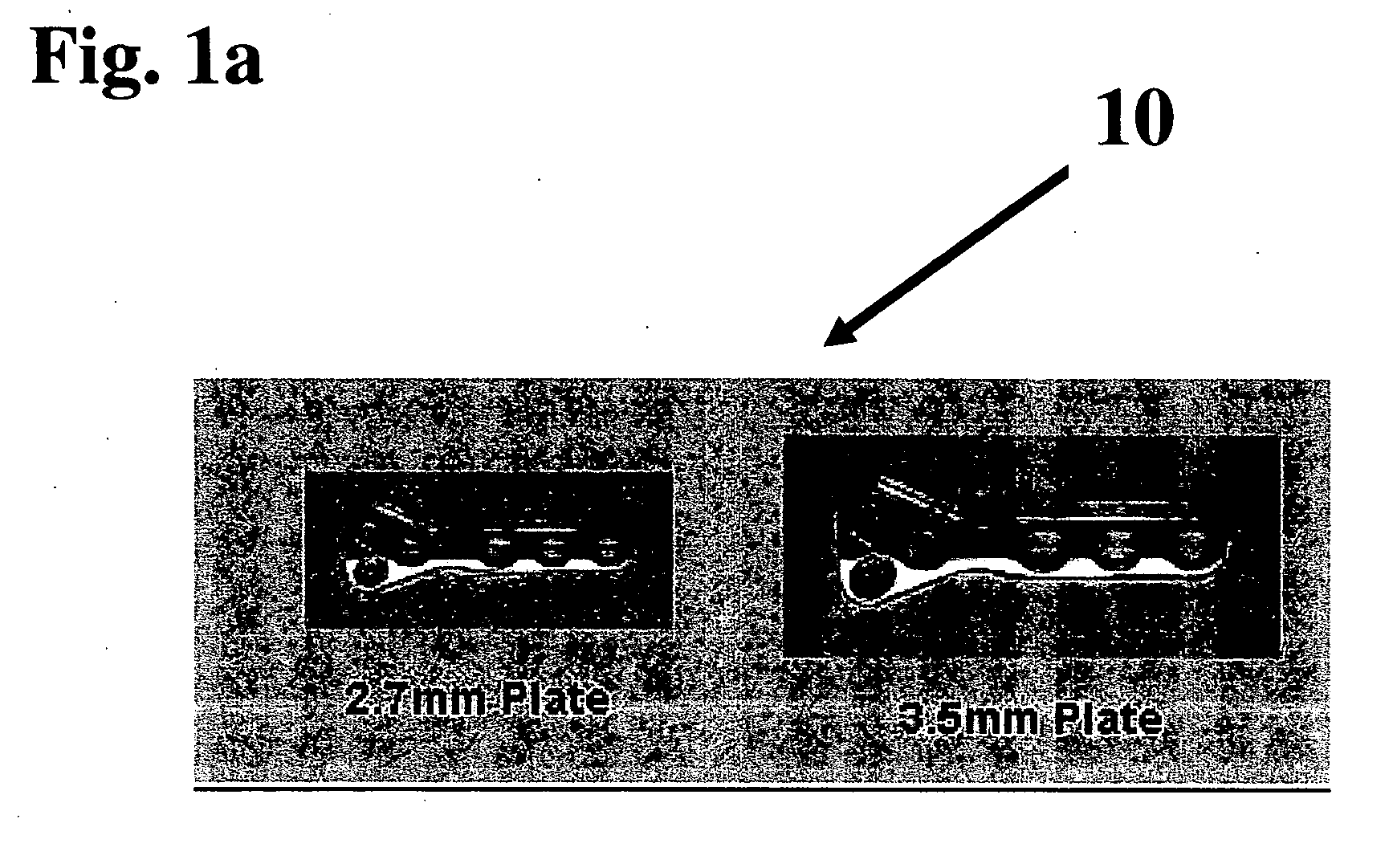 Multi-purpose bone plate system