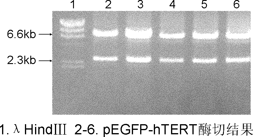 Preparation method of immortalized human intervertebral disc nucleus pulposus cell system