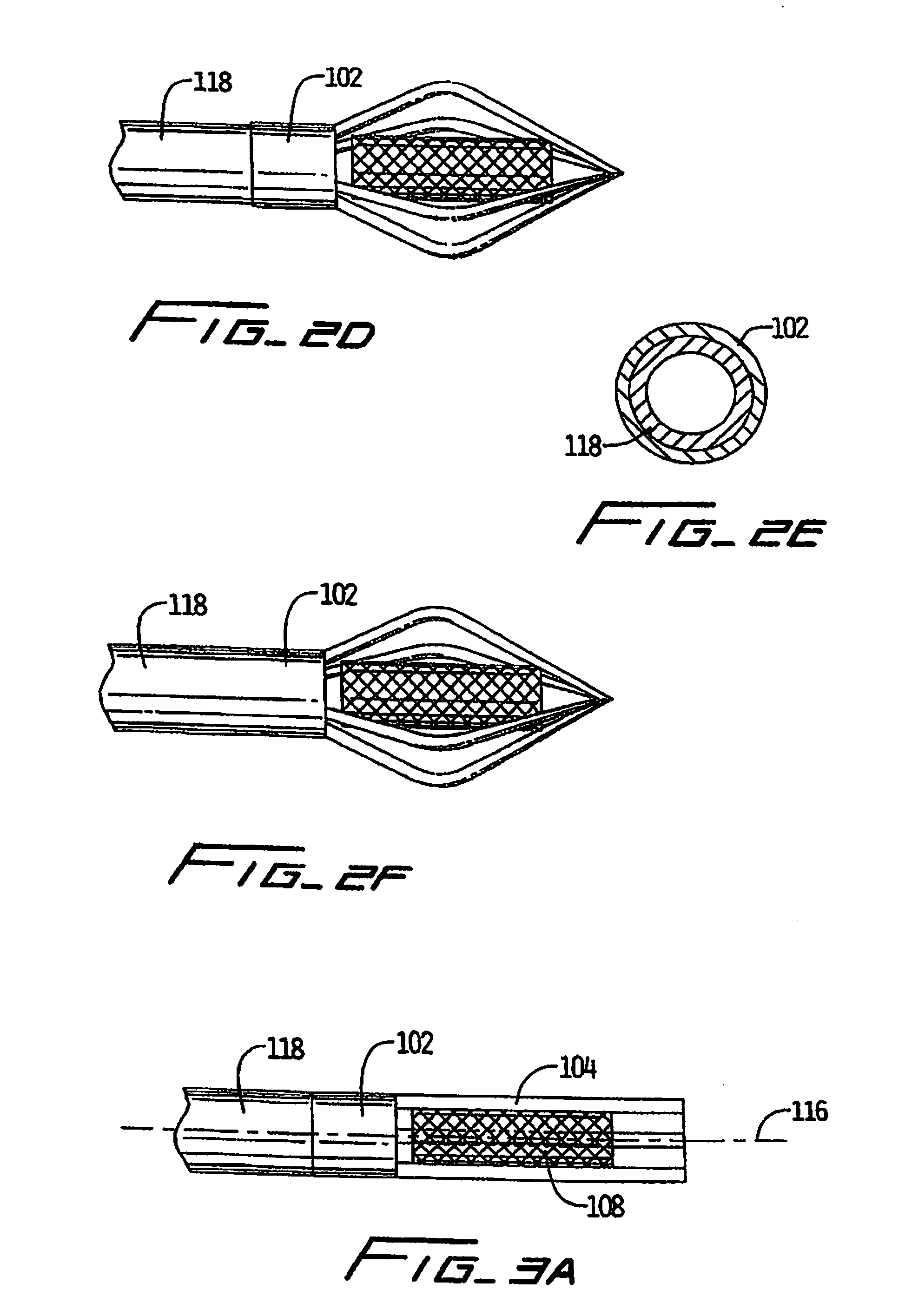 Method And Apparatus For Caged Stent Delivery