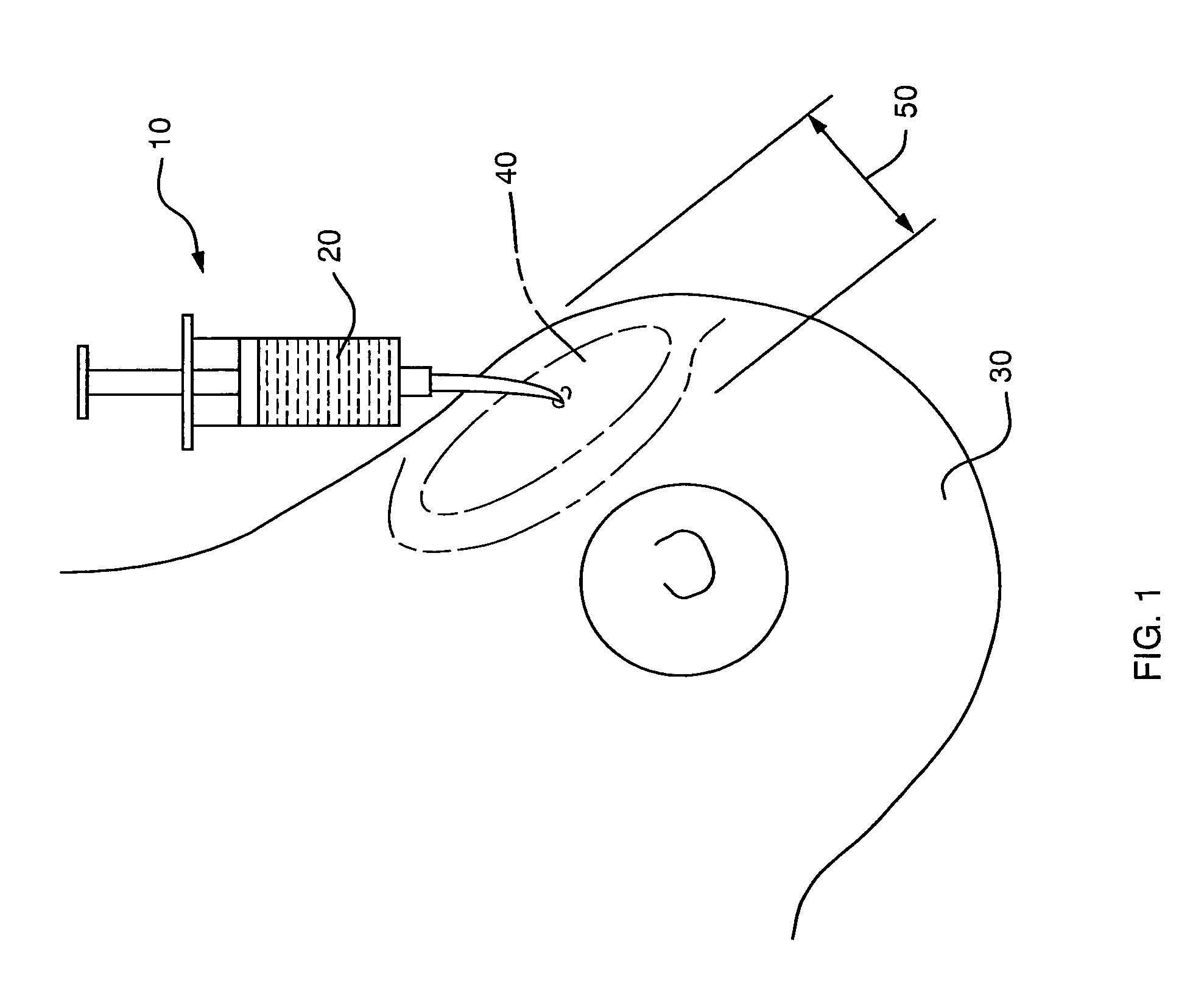 Tumescent skin spacing method