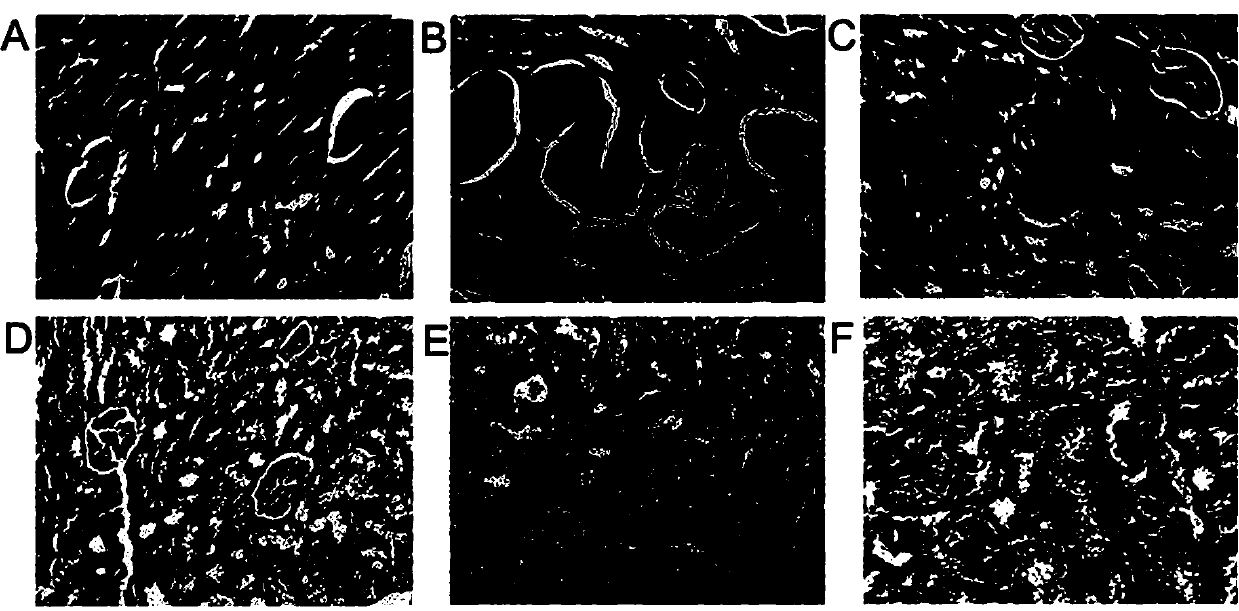 Nephrotic syndrome progression-related metabolic markers and application thereof