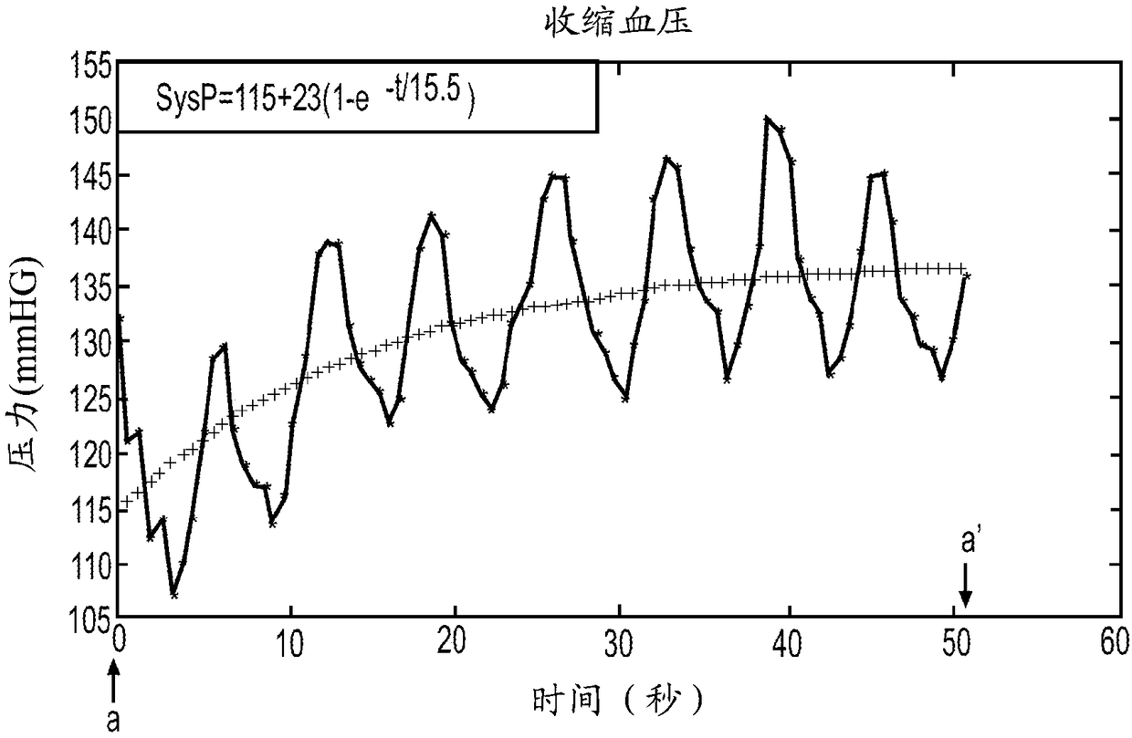 Methods and Systems for Lowering Blood Pressure Through Reduction of Ventricle Filling