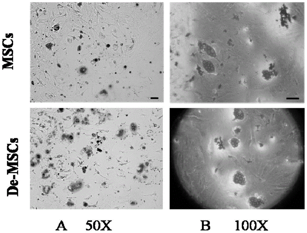 A method for culturing bone marrow dedifferentiated mesenchymal stem cells