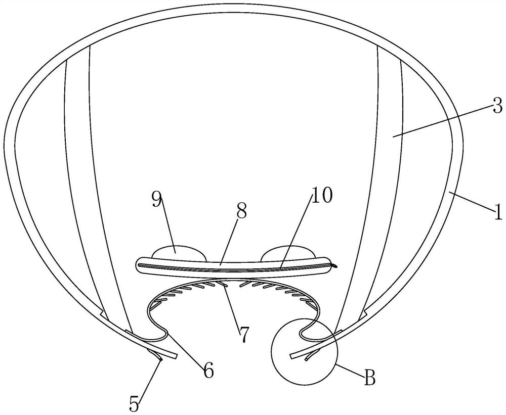 Hernia belt for hernia treatment in general surgery department